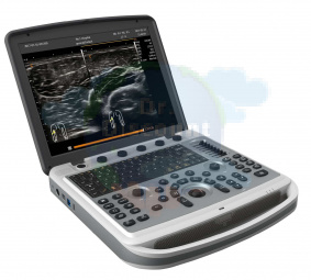 УЗИ аппарат CHISON SonoBook 6