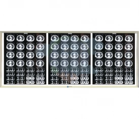 Негатоскоп LED 3-кадровый